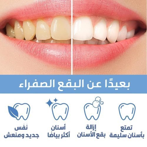 قلم تبييض الاسنان - الصورة 4