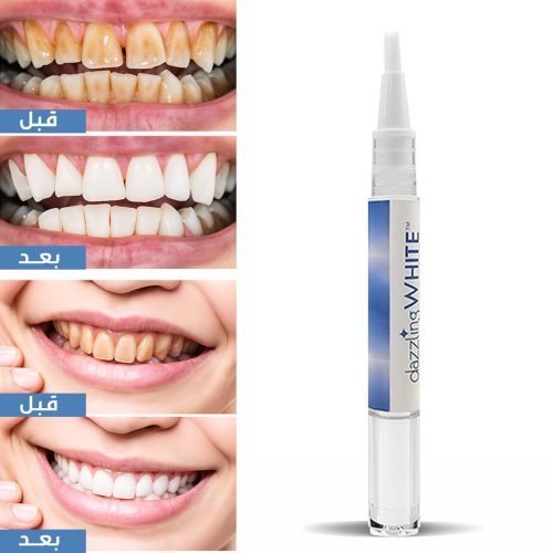 قلم تبييض الاسنان - الصورة 3